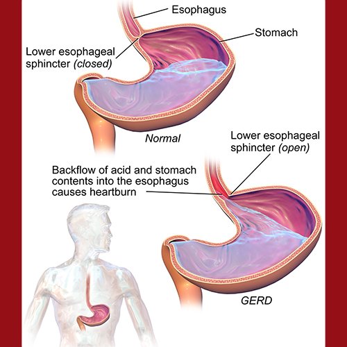 dr-della-parker_improved-stomach-acid-in-just-one-minute